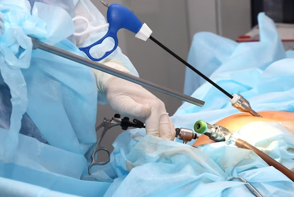 Laparoscopic Hysterectomy