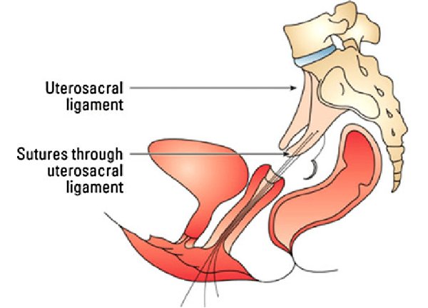 High Risk Pregnancy Care